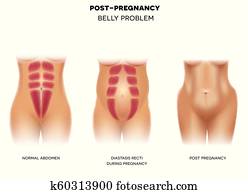 Female body before pregnancy, during pregnancy and after Female body before pregnancy, during pregnancy and after