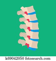 menschlich, wirbel, lumbal, rückenschmerzen, krankheit, patient, vektor, icon., skelettartig, krank, rückgrat, hinterer knochen, spalte, scheibe, medizinische menschlich, wirbel, lumbal, rückenschmerzen, krankheit, patient, vektor, icon., skelettartig, krank, rückgrat, hinterer knochen, spalte, scheibe, medizinische