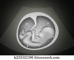 ultrasound in pregnancy ultrasound in pregnancy