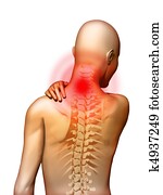 כאב של צוואר