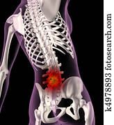 Back ache in a female skeleton Back ache in a female skeleton
