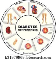 Diabetes complications Diabetes complications