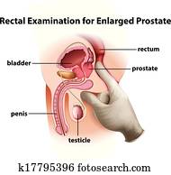 של החלחולת, בחינה, ל, הגדל, ערמונית
