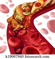 colesterol, bloqueado, artéria