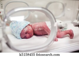 Newborn baby covered in vertix in incubator Newborn baby covered in vertix in incubator