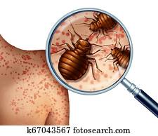 Bed Bug Bites Bed Bug Bites