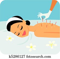 acupuncture, illustration
