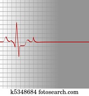 grid with heart beat and then flatline grid with heart beat and then flatline