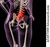 Overweight female skeleton with back pain Overweight female skeleton with back pain