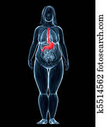 太り過ぎの女性 器官 イラスト K Fotosearch