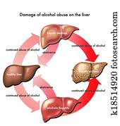 liver and alcohol liver and alcohol