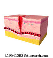 Tissue repair on human skin Tissue repair on human skin