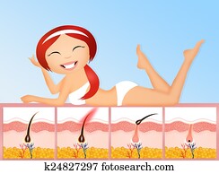 permanent, epilation