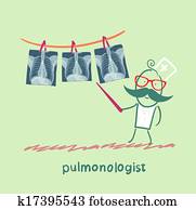 pulmonologist, מראה, an, רנטגן, של, ריאה אנושית