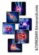 Human Joint Pain Human Joint Pain