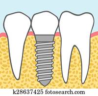 של השיניים, השרש