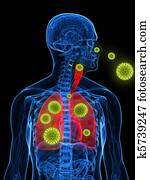 pólen, alergia, ilustração