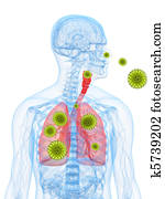 pólen, alergia, ilustração