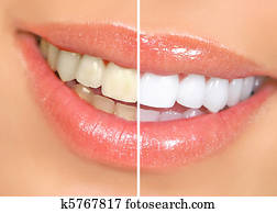 woman teeth woman teeth