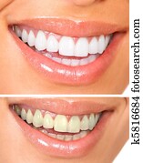 Healthy teeth Healthy teeth