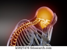 Head Pain concept Head Pain concept
