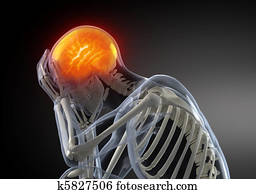 Head Pain concept Head Pain concept