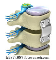 של השדרה, קיבעון, מערכת