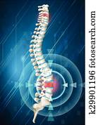 Human spine showing back pain Human spine showing back pain