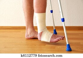 verband, op, de, been