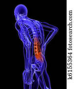 backache illustration backache illustration