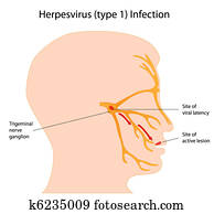 herpesvirus, infecção