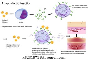 mechanismus, von, allergie mechanismus, von, allergie