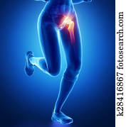 Pain in hip Pain in hip