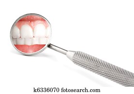 רופא שניים, שקף