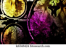 צבעוני, רנטגן, סרוק, של, מוח