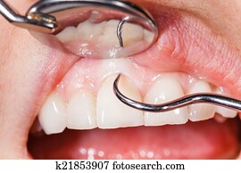 Dental examination Dental examination
