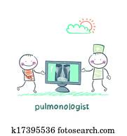 pulmonologist,, רנטגן של חזה, מראה, a, חולה