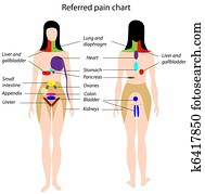 referred, schmerz, chart,, eps8 referred, schmerz, chart,, eps8