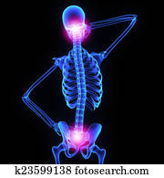 Neck and hip joint Neck and hip joint