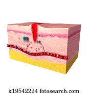 Tissue repair on human skin Tissue repair on human skin