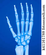 Lateral view of the skeletal anatomy of the right arm (carpals
