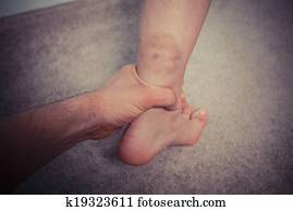 Man grabbing woman's bruised leg