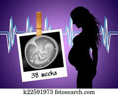 pregnancy to term pregnancy to term