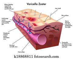 varicella, zoster, vírus