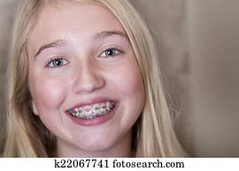 teen girl with braces on her teeth teen girl with braces on her teeth