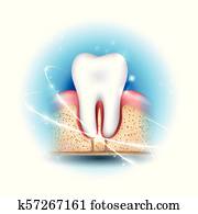 בריאות של השיניים, דאג