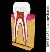 Dentistry: Tooth cut or section