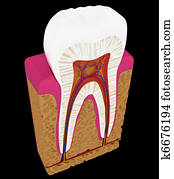 Tooth cut or section isolated