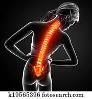 Female back pain anatomy Female back pain anatomy