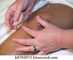 Acupuncture of the knee Acupuncture of the knee